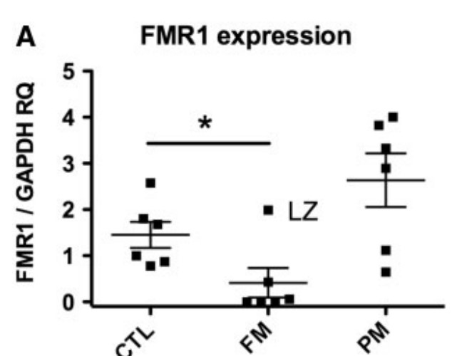 Expression of FMR1 in clinical samples.jpg